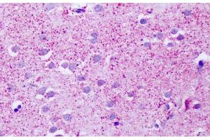 Human, Brain, Cortex, Neurons:  Formalin-Fixed Paraffin-Embedded (FFPE) (GPR139 antibody  (Cytoplasmic Domain))