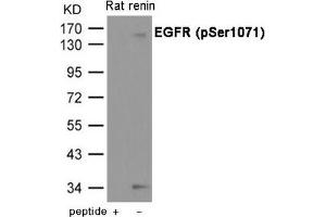 Western blot analysis of extracts from Rat renin using EGFR (Phospho-Ser1071) Antibody. (EGFR antibody  (pSer1071))