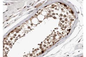 ABIN6267348 at 1/100 staining human Testis tissue sections by IHC-P. (MYB antibody  (pSer532))