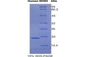 SDS-PAGE analysis of Human NOS3 Protein.