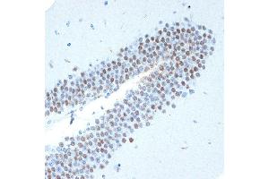 Immunohistochemistry of paraffin-embedded mouse brain using CHD3 Rabbit mAb (ABIN7266363) at dilution of 1:100 (40x lens). (CHD3 antibody)