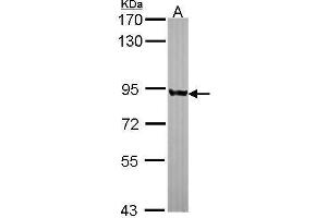 WB Image Sample (30 ug of whole cell lysate) A: JurKat 7. (PNPT1 antibody  (N-Term))