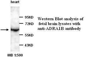 Image no. 1 for anti-Adrenergic, alpha-1B-, Receptor (ADRA1B) antibody (ABIN790879)