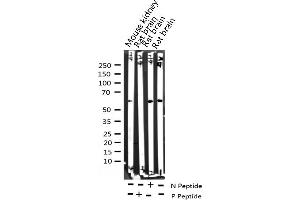 Western blot analysis of Phospho-Myc (Thr58) expression in various lysates (c-MYC antibody  (pThr58))