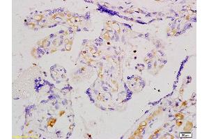 Formalin-fixed and paraffin embedded human placenta tissue labeled with Anti-Angiomotin Polyclonal Antibody, Unconjugated (ABIN754873) at 1:200 followed by conjugation to the secondary antibody and DAB staining (Angiomotin antibody  (AA 545-620))