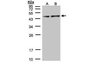 WB Image Sample(30 μg of whole cell lysate) A:Hep G2, B:MOLT4, 12% SDS PAGE antibody diluted at 1:1000 (Pyruvate Dehydrogenase E1 alpha (Center) antibody)