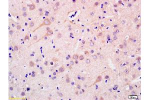 Formalin-fixed and paraffin embedded rat brain labeled with Anti-ADCY1 Polyclonal Antibody, Unconjugated (ABIN702565) at 1:200 followed by conjugation to the secondary antibody and DAB staining. (ADCY1 antibody  (AA 751-850))