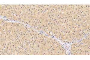 Detection of F12 in Human Liver Tissue using Polyclonal Antibody to Coagulation Factor XII (F12) (F12 antibody  (AA 400-615))