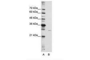 Image no. 2 for anti-EMG1 Nucleolar Protein Homolog (EMG1) (AA 51-100) antibody (ABIN6736233) (EMG1 antibody  (AA 51-100))