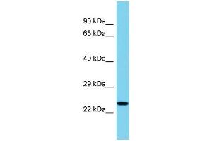 Host: Rabbit Target Name: IL34 Sample Type: U937 Whole Cell lysates Antibody Dilution: 1.