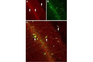 Expression of CACNB3 (CaVβ3) in rat hippocampus - Immunohistochemical staining of rat hippocampus with Anti-CACNB3 Antibody (ABIN7042987, ABIN7043959 and ABIN7043960). (CACNB3 antibody  (C-Term, Intracellular))