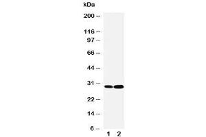 Western blot testing of LASP1 antibody and Lane 1:  HeLa