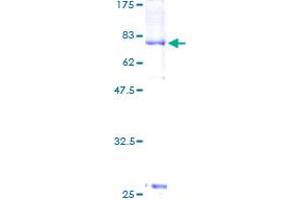 Image no. 2 for Cyclin-Dependent Kinase 18 (CDK18) (AA 1-472) protein (GST tag) (ABIN1314378) (CDK18 Protein (AA 1-472) (GST tag))