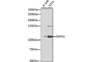 Western blot analysis of extracts of various cell lines, using INPP5J antibody (ABIN6132490, ABIN6142471, ABIN6142472 and ABIN6222324) at 1:1000 dilution. (INPP5J antibody  (AA 60-360))