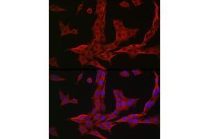 Immunofluorescence (IF) image for anti-NAD(P)H Dehydrogenase, Quinone 1 (NQO1) (AA 1-274) antibody (ABIN1681096)