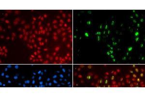 Immunofluorescence analysis of GFP-RNF168 transgenic U2OS cells using DNA polymerase eta Polyclonal Antibody (POLH antibody)