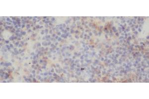 Immunohistochemistry of paraffin-embedded Rat spleen using RELB Polyclonal Antibody at dilution of 1:50 (RELB antibody)