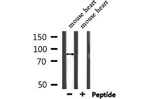 Western blot analysis of extracts from mouse heart, using NEB2 Antibody.