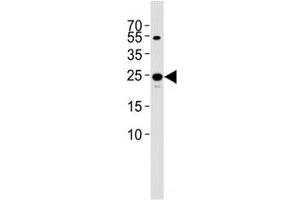 Western blot analysis of lysate from 293T cell line using TFAM antibody diluted at 1:1000. (TFAM antibody  (AA 216-246))
