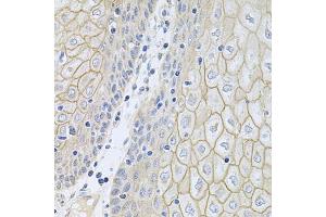 Immunohistochemistry of paraffin-embedded human esophagus using NCR3 antibody (ABIN5974302) at dilution of 1/100 (40x lens). (NCR3 antibody)