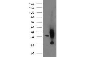 HEK293T cells were transfected with the pCMV6-ENTRY control (Left lane) or pCMV6-ENTRY AK4 (Right lane) cDNA for 48 hrs and lysed. (AK4 antibody)