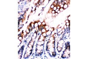 Anti-Fatty Acid Binding Protein 5 antibody, IHC(P) IHC(P): Rat Intestine Tissue (FABP5 antibody  (N-Term))