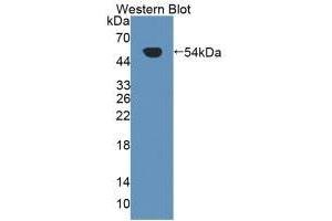 Detection of Recombinant Kim1, Human using Polyclonal Antibody to Kidney Injury Molecule 1 (Kim1) (HAVCR1 antibody  (AA 21-240))