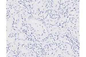 ABIN570861 Negative Control showing staining of paraffin embedded Human Cerebellum, with no primary antibody. (NIPBL antibody  (AA 889-902))