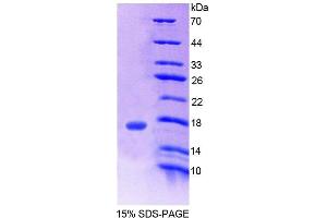 SDS-PAGE (SDS) image for Cholinergic Receptor, Nicotinic, beta 3 (Neuronal) (CHRNB3) (AA 119-230) protein (His tag) (ABIN4989736)