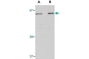 Western blot analysis of LASS5 in rat brain tissue lysate with LASS5 polyclonal antibody  at (A) 1 and (B) 2 ug/mL . (LASS5 antibody  (N-Term))
