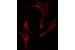 ABIN6275641 staining LOVO cells by IF/ICC. (EIF2B4 antibody  (Internal Region))
