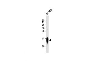 LC3 Antibody at 1:5000 dilution + recombinant protein Lysates/proteins at 20 μg per lane.