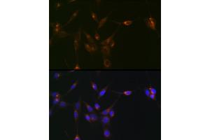 Immunofluorescence analysis of NIH/3T3 cells using PDLIM1/CLP36 Rabbit mAb (ABIN7269195) at dilution of 1:100 (40x lens). (PDLIM1 antibody)