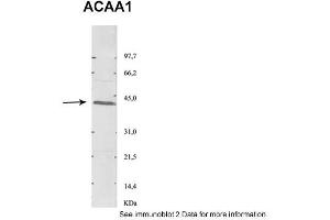Sample Type: 1. (ACAA1 antibody  (N-Term))