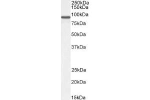 Centaurin beta 2 antibody  (C-Term)