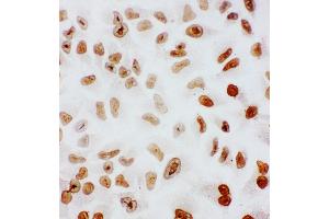 Anti-splicing factor 1 antibody, ICC ICC: HELA Cell (Splicing Factor 1 antibody  (N-Term))