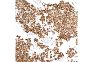 Immunohistochemistry (IHC) image for anti-CD163 (CD163) (AA 850-900) antibody (ABIN7448890) (Recombinant CD163 antibody  (AA 850-900))
