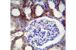 Caspase-3 antibody immunohistochemistry analysis in formalin fixed and paraffin embedded human kidney tissue. (Caspase 3 antibody  (AA 219-248))
