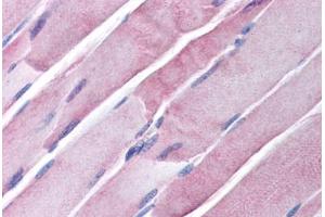 Human Skeletal Muscle (formalin-fixed, paraffin-embedded) stained with GOT2 antibody ABIN291150 at 20 ug/ml followed by biotinylated secondary antibody, alkaline phosphatase-streptavidin and chromogen. (GOT1 antibody)
