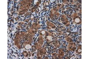 Immunohistochemical staining of paraffin-embedded Kidney tissue using anti-KIAA1609 mouse monoclonal antibody. (KIAA1609 antibody)