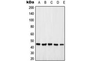 Western blot analysis of PSMD6 expression in HeLa (A), Jurkat (B), HEK293T (C), SP2/0 (D), PC12 (E) whole cell lysates. (PSMD6 antibody  (Center))