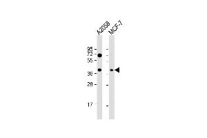 All lanes : Anti-GNA12 Antibody (S67) at 1:1000 dilution Lane 1:  whole cell lysate Lane 2: MCF-7 whole cell lysate Lysates/proteins at 20 μg per lane. (GNA12 antibody  (AA 46-75))