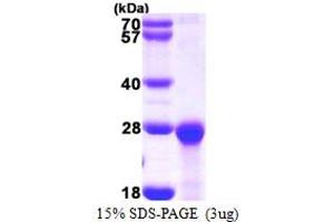 PEST Proteolytic Signal Containing Nuclear Protein (PCNP) (AA 1-178) protein (His tag)