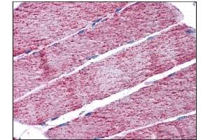 Human Skeletal Muscle: Formalin-Fixed, Paraffin-Embedded (FFPE) (FH antibody  (Internal Region))