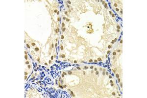 Immunohistochemistry of paraffin-embedded mouse testis using DDB1 Antibody (ABIN5971498) at dilution of 1/200 (40x lens). (DDB1 antibody)