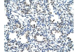 CBX3 antibody was used for immunohistochemistry at a concentration of 4-8 ug/ml to stain Alveolar cells (arrows) in Human Lung.