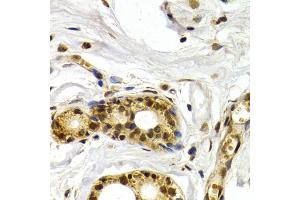Immunohistochemistry of paraffin-embedded human mammary gland using ATF2 antibody (ABIN5971182) at dilution of 1/200 (40x lens). (ATF2 antibody)
