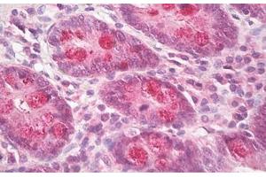 Image no. 1 for anti-Intestinal Cell (MAK-Like) Kinase (ICK) (AA 448-497) antibody (ABIN6749783) (ICK antibody  (AA 448-497))