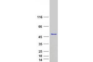 Western Blotting (WB) image for Endonuclease 8-like 2 (NEIL2) (Transcript Variant 1) protein (Myc-DYKDDDDK Tag) (ABIN2727071)