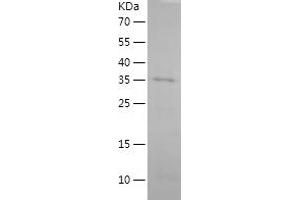 Western Blotting (WB) image for Somatostatin (SST) (AA 1-116) protein (His-IF2DI Tag) (ABIN7283236) (Somatostatin Protein (SST) (AA 1-116) (His-IF2DI Tag))